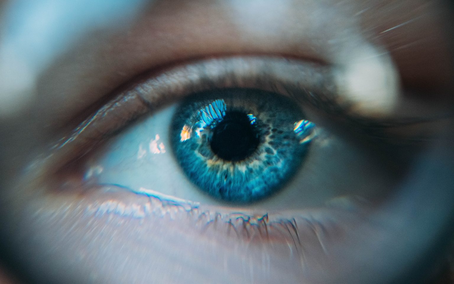 Q&A: Netra.ai uses Intel technologies to identify diabetic retinopathy